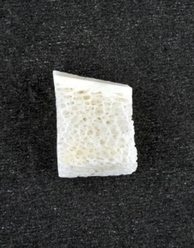 Bone-gaining techniques