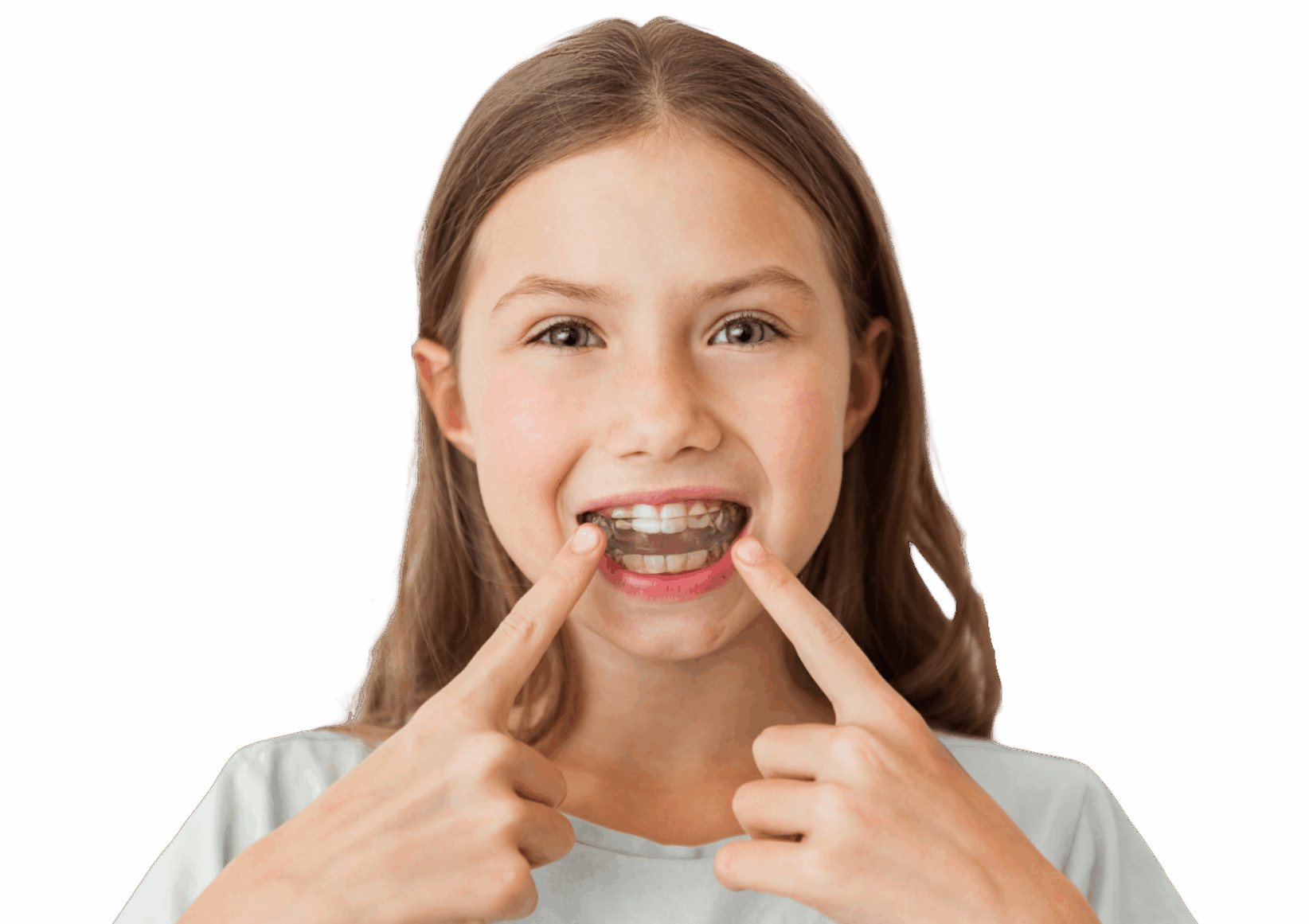 Interceptive Orthodontics