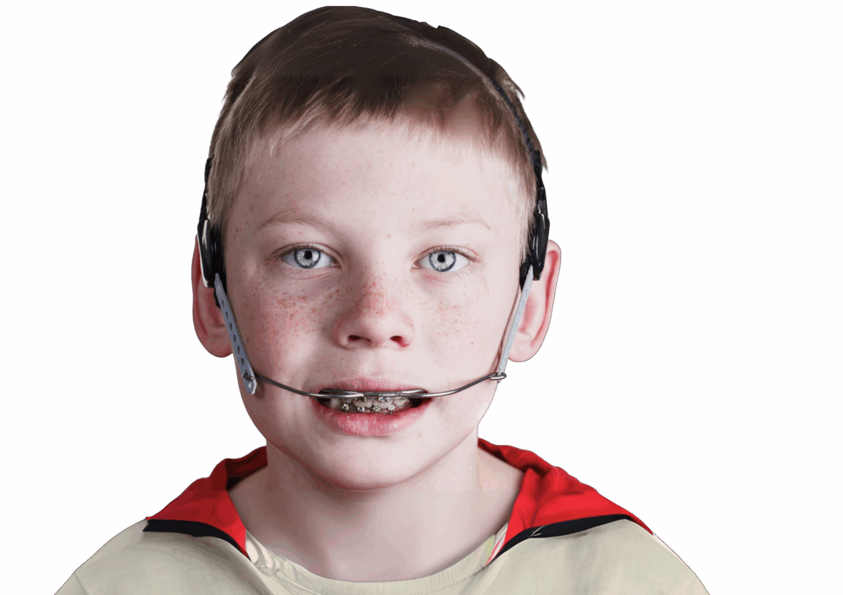 Corrective orthodontics